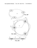 Craniotomy Closures and Plugs diagram and image