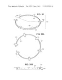 Craniotomy Closures and Plugs diagram and image