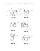 COUPLING MODULE OF A MODULAR IMPLANTABLE MEDICAL DEVICE diagram and image