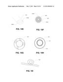 COUPLING MODULE OF A MODULAR IMPLANTABLE MEDICAL DEVICE diagram and image