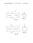 IMPLANTABLE MEDICAL DEVICES diagram and image