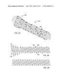 IMPLANTABLE MEDICAL DEVICES diagram and image