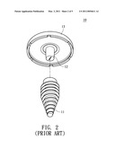 Implant Structure diagram and image