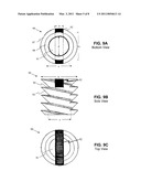 SPINAL IMPLANT AND METHOD diagram and image