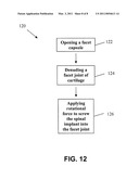 SPINAL IMPLANT AND METHOD diagram and image