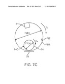 METHOD TO PREVENT STENT DAMAGE CAUSED BY LASER CUTTING diagram and image