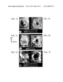 METHODS OF AGING ALUMINUM ALLOYS TO ACHIEVE IMPROVED BALLISTICS PERFORMANCE diagram and image