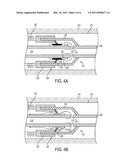 Well Assembly With Removable Fluid Restricting Member diagram and image