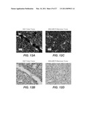 ANTI-ROBO4 ANTIBODIES AND USES THEREFOR diagram and image