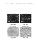 ANTI-ROBO4 ANTIBODIES AND USES THEREFOR diagram and image