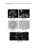 ANTI-ROBO4 ANTIBODIES AND USES THEREFOR diagram and image