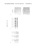 GAB2 AMPLIFICATION IN MELANOMA diagram and image