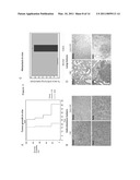 GAB2 AMPLIFICATION IN MELANOMA diagram and image