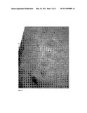 TREATMENT OF DISEASES AND CONDITIONS MEDIATED BY EICOSANOIDS diagram and image