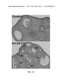 LONIDAMINE ANALOGUES FOR FERTILITY MANAGEMENT diagram and image