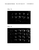 Pyruvate Derivatives with Neuroprotective Effect, Process for Preparing the Same and Pharmaceutical Composition Comprising the Same diagram and image