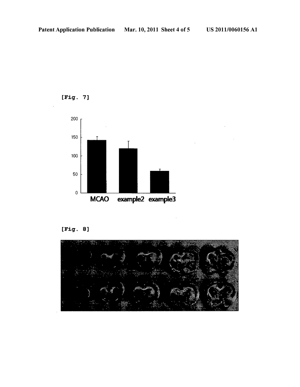 Pyruvate Derivatives with Neuroprotective Effect, Process for Preparing the Same and Pharmaceutical Composition Comprising the Same - diagram, schematic, and image 05