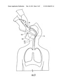INSERTION AID FOR ORAL AND NASAL MEDICAL DEVICES diagram and image