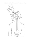 INSERTION AID FOR ORAL AND NASAL MEDICAL DEVICES diagram and image