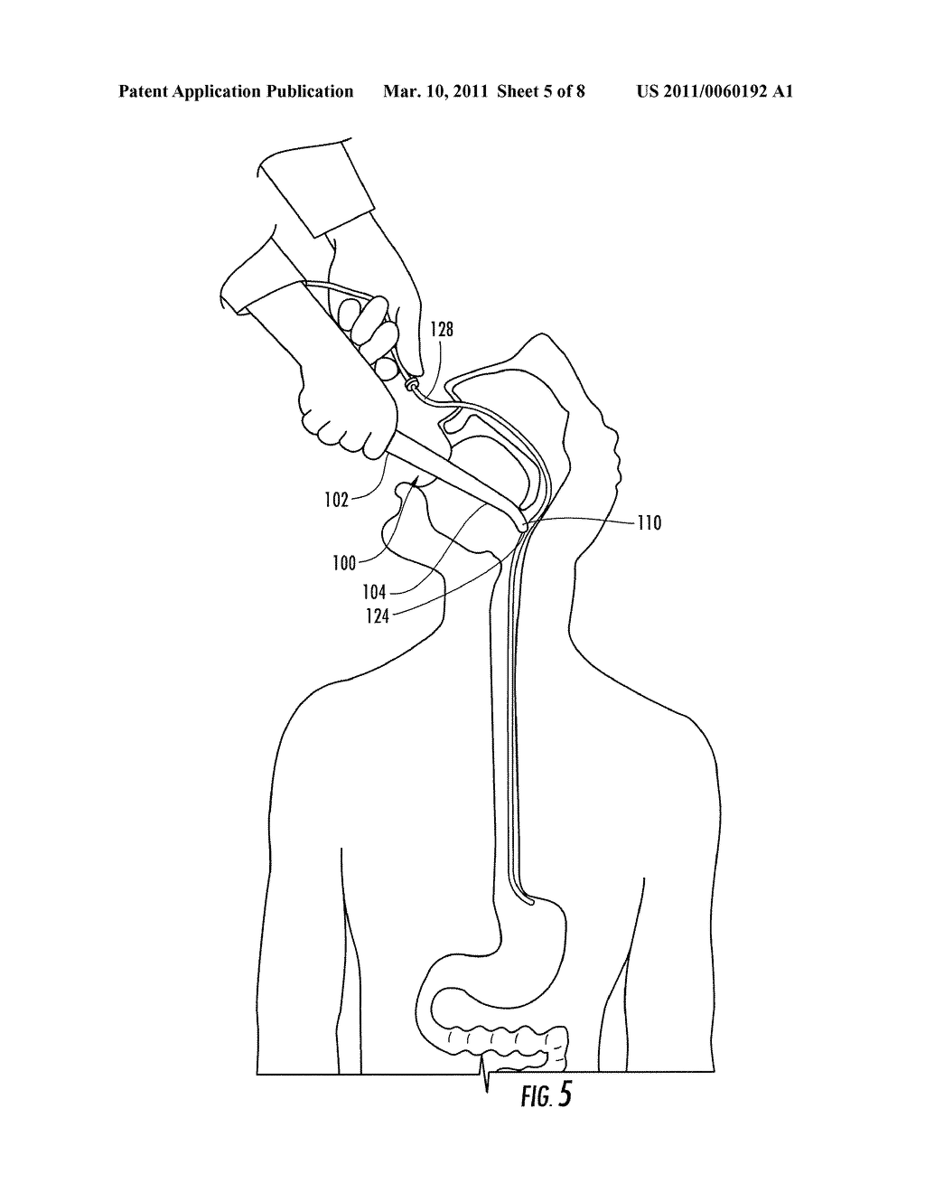 INSERTION AID FOR ORAL AND NASAL MEDICAL DEVICES - diagram, schematic, and image 06