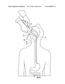 INSERTION AID FOR ORAL AND NASAL MEDICAL DEVICES diagram and image