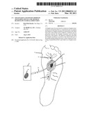 NON-INVASIVE CONTINUOUS DOPPLER MONITORING DEVICE FOR ARTERIAL BLOOD FLOW TO DISTAL BODY PARTS diagram and image