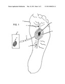 NON-INVASIVE CONTINUOUS DOPPLER MONITORING DEVICE FOR ARTERIAL BLOOD FLOW TO DISTAL BODY PARTS diagram and image