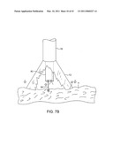 TISSUE VISUALIZATION AND MANIPULATION SYSTEM diagram and image