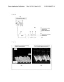 RESPIRATION IMPEDANCE MEASURING DEVICE AND METHOD, AND RESPIRATION IMPEDANCE DISPLAY METHOD diagram and image