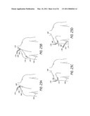 DEVICE AND METHOD FOR VASCULAR ACCESS diagram and image