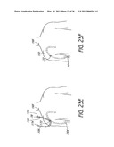 DEVICE AND METHOD FOR VASCULAR ACCESS diagram and image