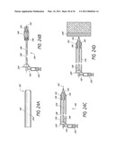 DEVICE AND METHOD FOR VASCULAR ACCESS diagram and image