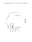 DEVICE AND METHOD FOR VASCULAR ACCESS diagram and image