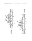 DEVICE AND METHOD FOR VASCULAR ACCESS diagram and image