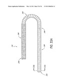 DEVICE AND METHOD FOR VASCULAR ACCESS diagram and image