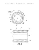 IMPLANTABLE SHUNT OR CATHETER ENABLING GRADUAL DELIVERY OF THERAPEUTIC AGENTS diagram and image