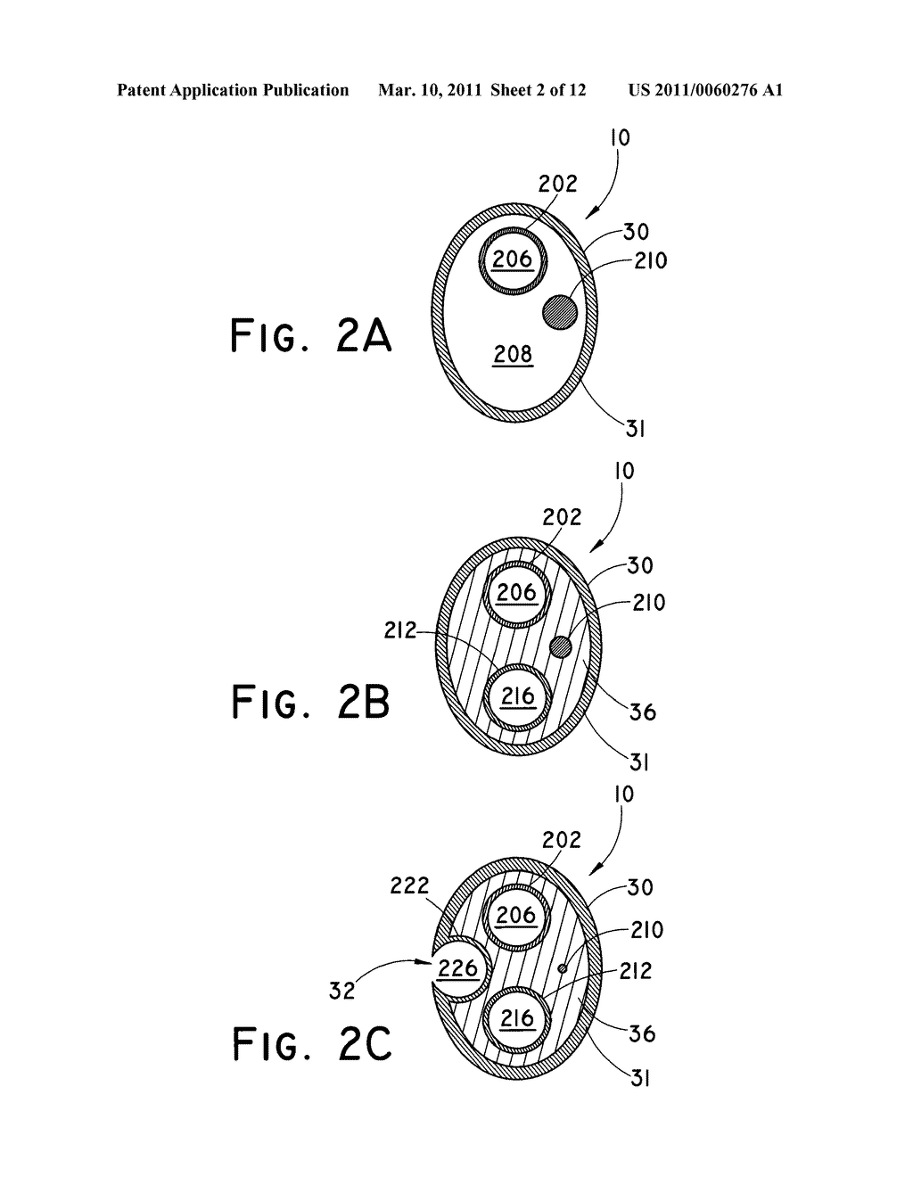 BALLOON CATHETER FOR DELIVERING A THERAPEUTIC AGENT - diagram, schematic, and image 03