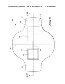 Wound covering and method for treating a wound diagram and image