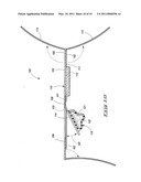 Wound covering and method for treating a wound diagram and image