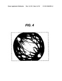 METHODS AND IMPLANTS FOR INDUCING SATIETY IN THE TREATMENT OF OBESITY diagram and image