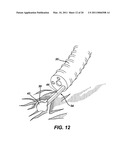 METHODS AND IMPLANTS FOR INDUCING SATIETY IN THE TREATMENT OF OBESITY diagram and image