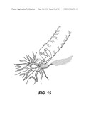 METHODS AND IMPLANTS FOR INDUCING SATIETY IN THE TREATMENT OF OBESITY diagram and image