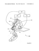 FOLLICULAR UNIT HARVESTING TOOL diagram and image