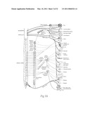 APPARATUS, SYSTEMS, AND METHODS FOR ACHIEVING INTRAVASCULAR, THERMALLY-INDUCED RENAL NEUROMODULATION diagram and image