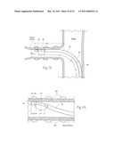 APPARATUS, SYSTEMS, AND METHODS FOR ACHIEVING INTRAVASCULAR, THERMALLY-INDUCED RENAL NEUROMODULATION diagram and image