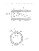 APPARATUS, SYSTEMS, AND METHODS FOR ACHIEVING INTRAVASCULAR, THERMALLY-INDUCED RENAL NEUROMODULATION diagram and image