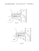 APPARATUS, SYSTEMS, AND METHODS FOR ACHIEVING INTRAVASCULAR, THERMALLY-INDUCED RENAL NEUROMODULATION diagram and image