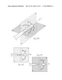 APPARATUS, SYSTEMS, AND METHODS FOR ACHIEVING INTRAVASCULAR, THERMALLY-INDUCED RENAL NEUROMODULATION diagram and image