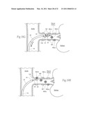 APPARATUS, SYSTEMS, AND METHODS FOR ACHIEVING INTRAVASCULAR, THERMALLY-INDUCED RENAL NEUROMODULATION diagram and image