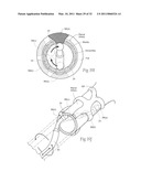 APPARATUS, SYSTEMS, AND METHODS FOR ACHIEVING INTRAVASCULAR, THERMALLY-INDUCED RENAL NEUROMODULATION diagram and image